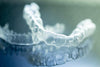 Why Choose Invisible Aligners Over DIY Braces? | NewSmile™
