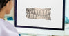 3D Before/After Treatment Preview Of Straight Teeth 